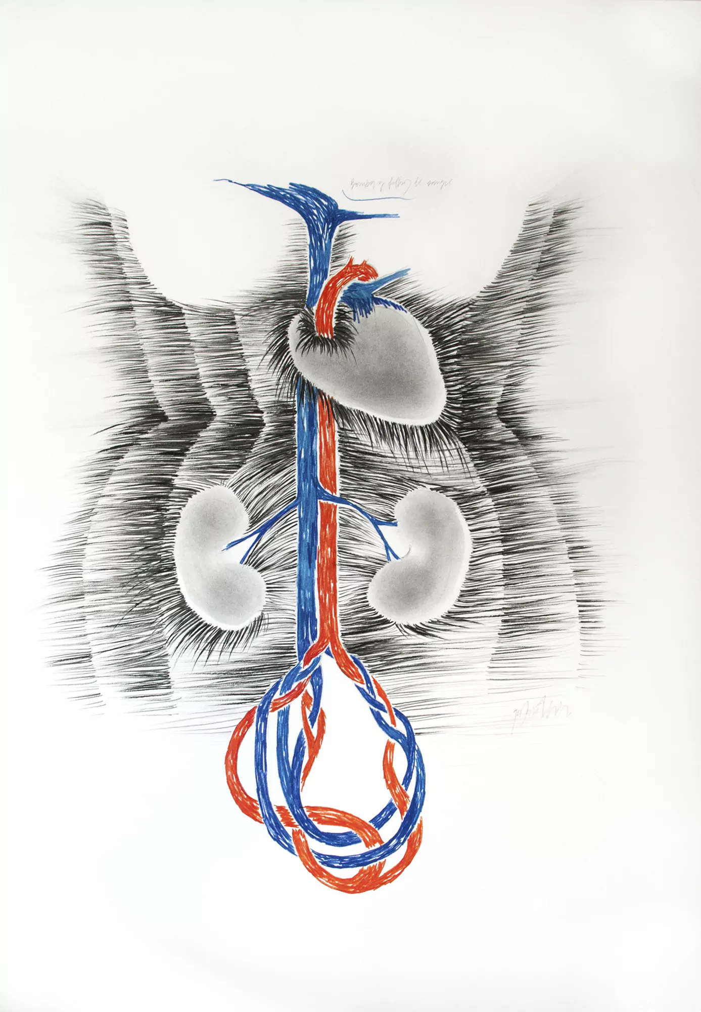 Bomba y filtros de sangre / Bomb and blood filter