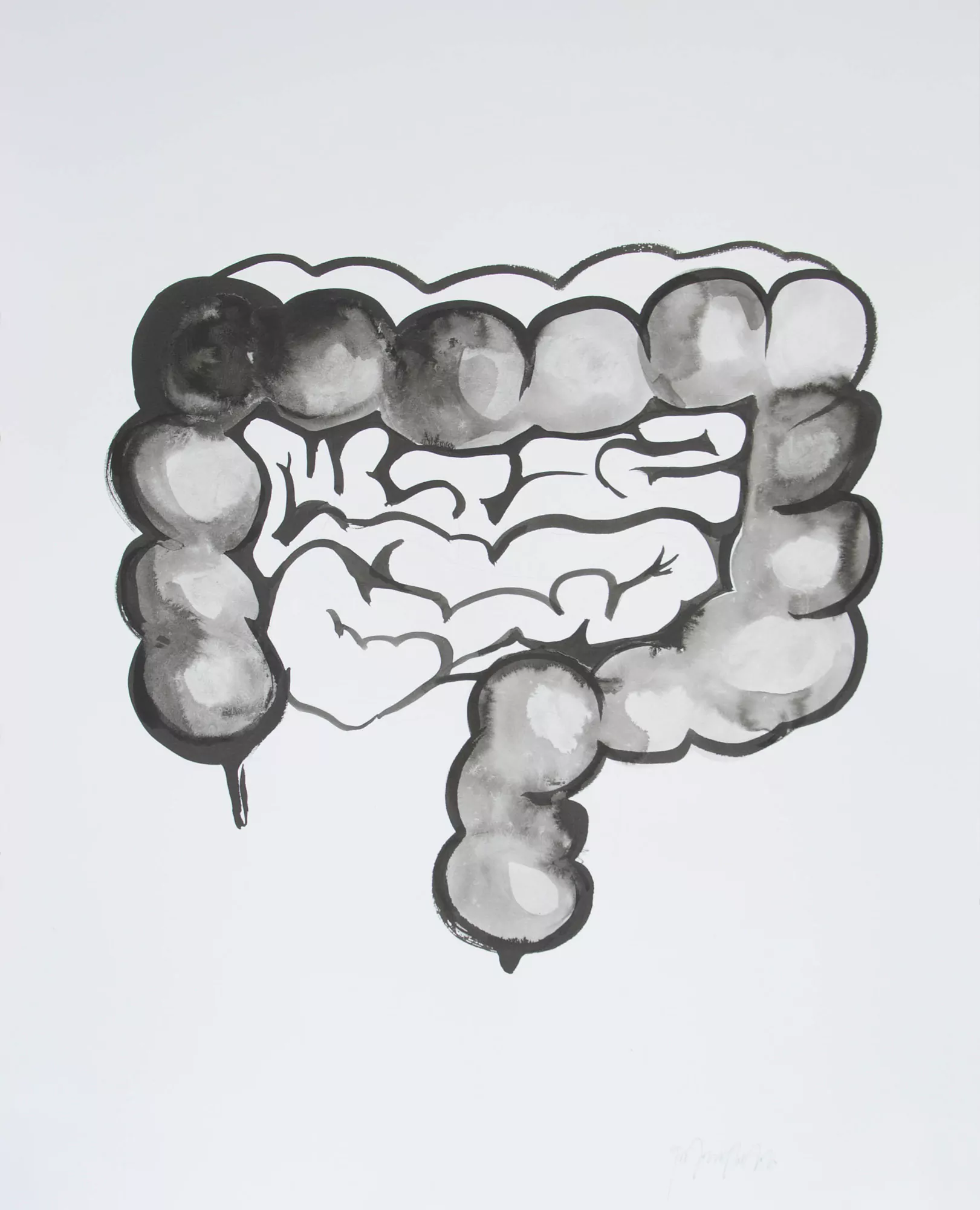 Intestino negro/  Black intestine